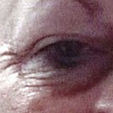 wrinkled-eyes